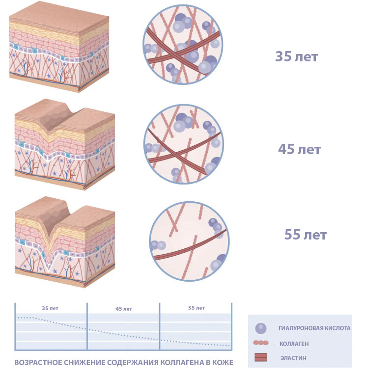 ВОЗРАСТНОЕ СНИЖЕНИЕ СОДЕРЖАНИЯ КОЛЛАГЕНА В КОЖЕ